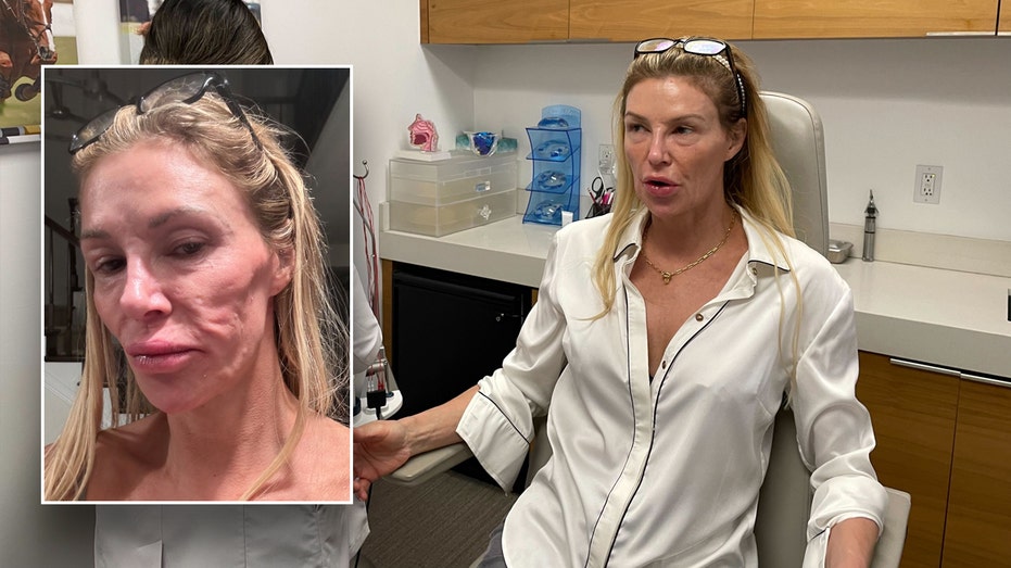 Brandi Glanville rushed to hospital while battling mystery illness that left her face disfigured
