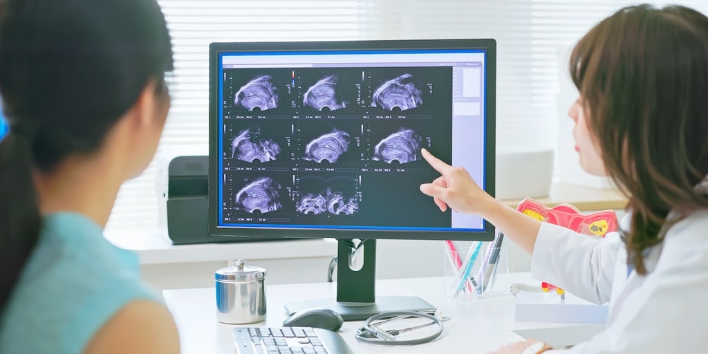 AI detects ovarian cancer better than human experts in new study