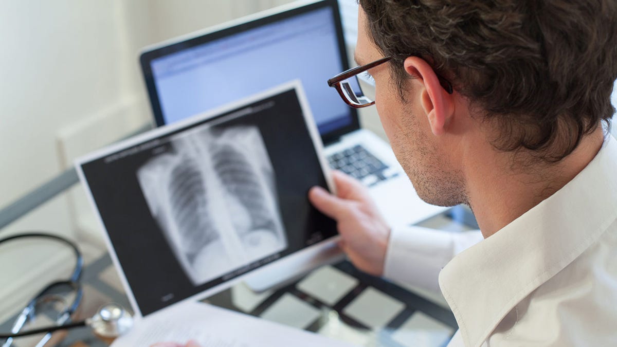 doctor checking x-ray of lungs