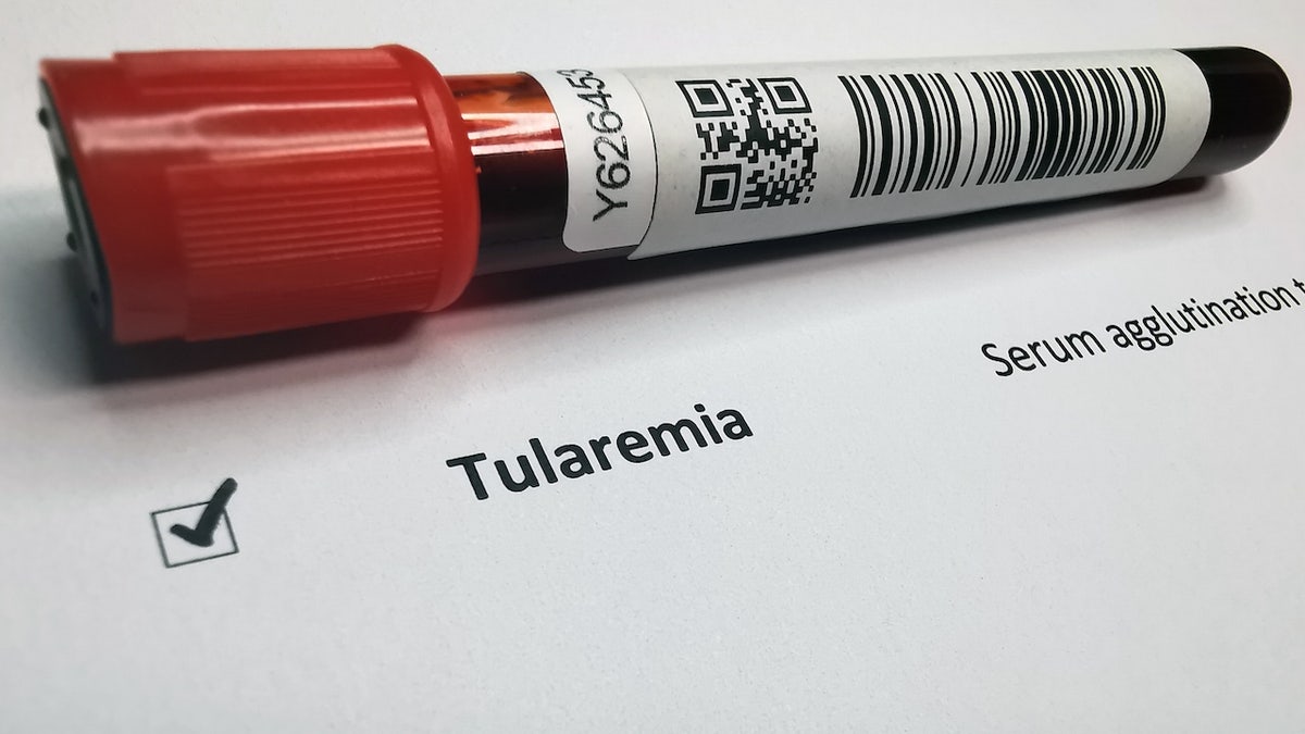 Tularemia