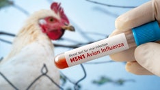 Louisiana reports first bird flu-related human death in US