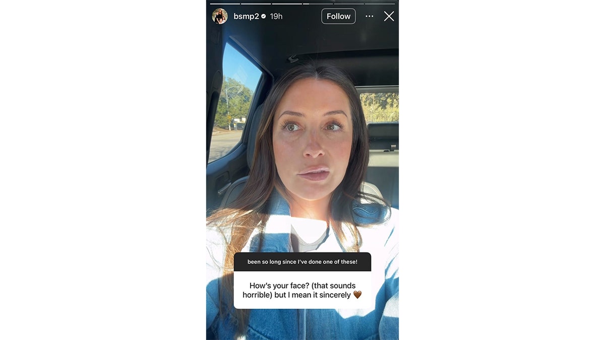 Bristol Palin shows facial paralysis