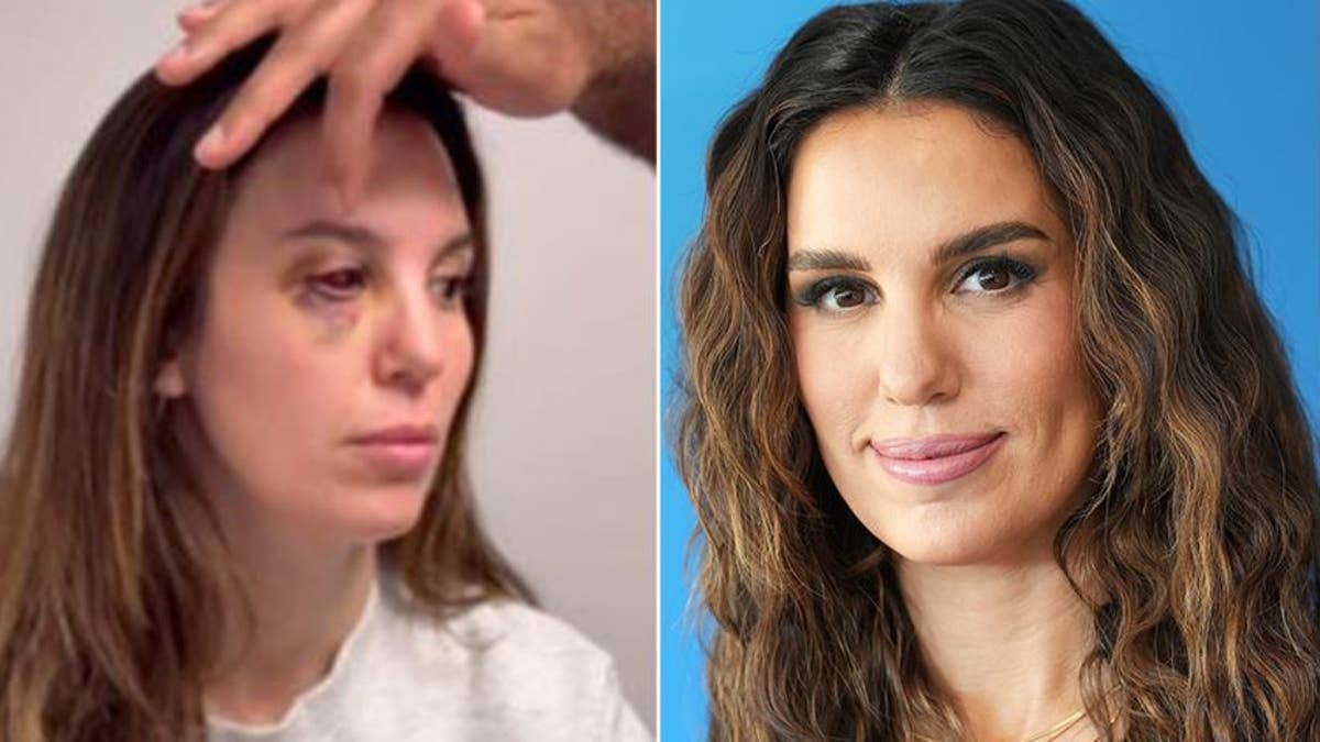 A split of Christy Carlson Romano before and after she was shot