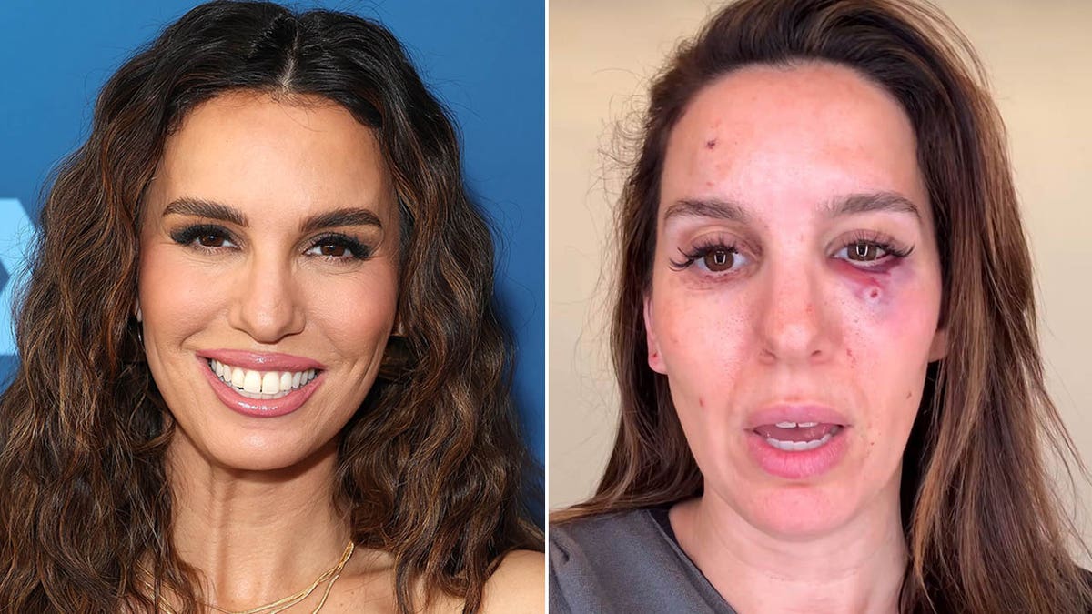 christy carlson romano on red carpet/christy with eye injury