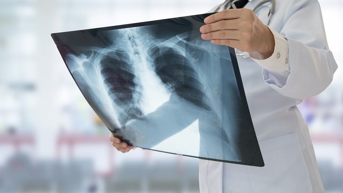 Doctor out of frame examining X-Ray