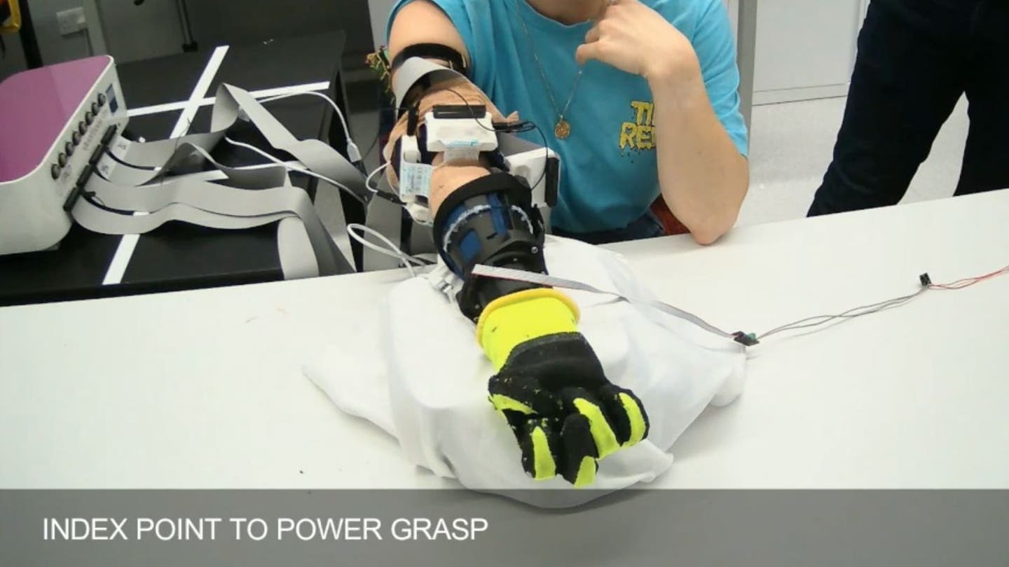 5 soft robotic prosthetic hand uses nerve signals for more natural control