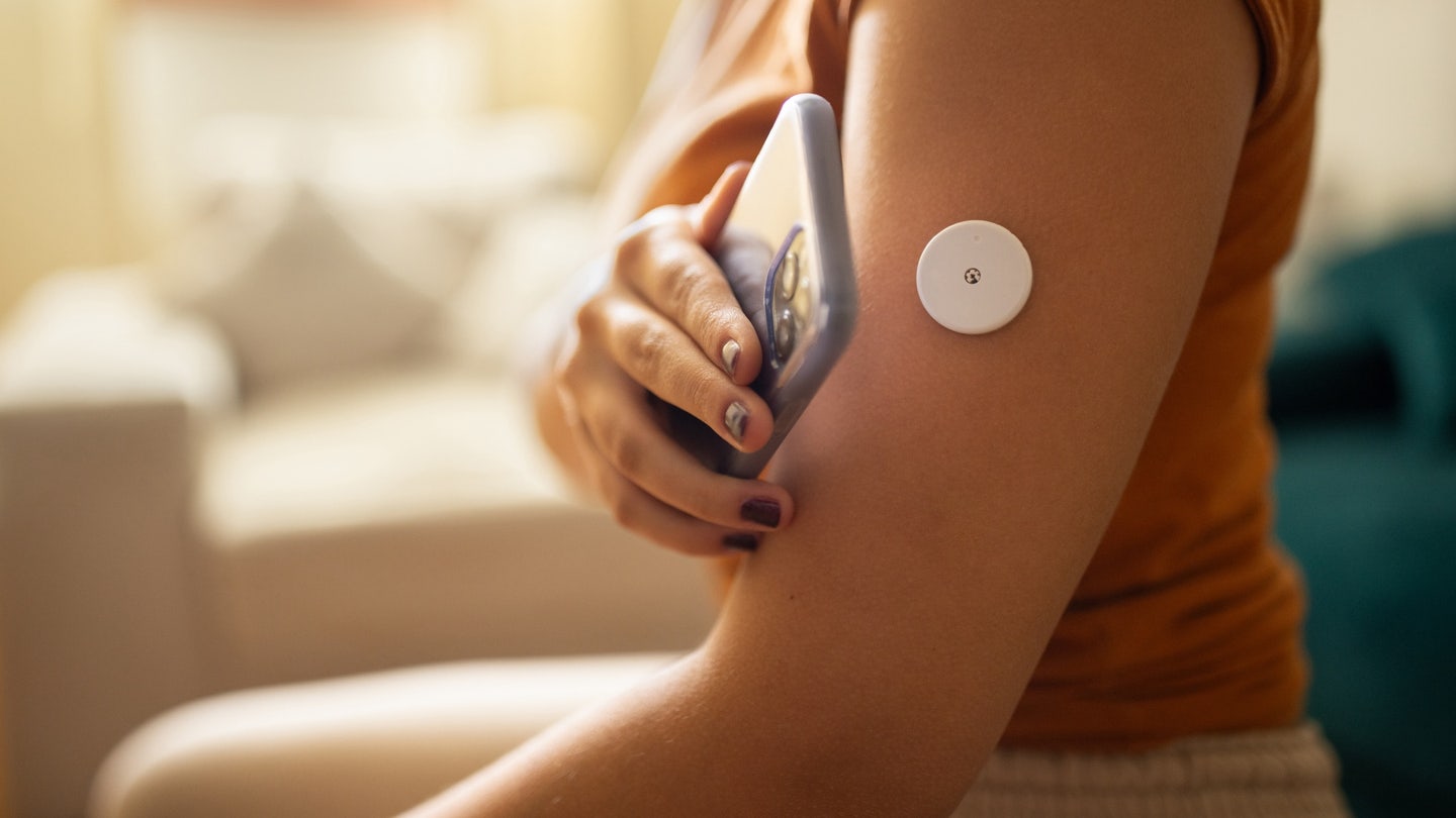 continuous glucose monitor