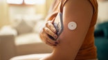 Continuous glucose monitor