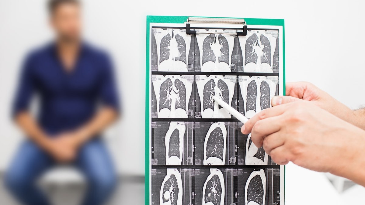 CT lung scan