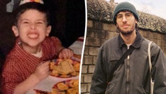 Man is allergic to 28 different foods, says life is 'increasingly difficult'