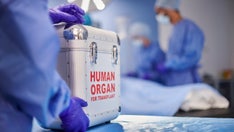 Patient dies from rabies after organ transplant from infected donor