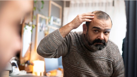 Men going bald turn to 'new Botox' for hair loss treatment