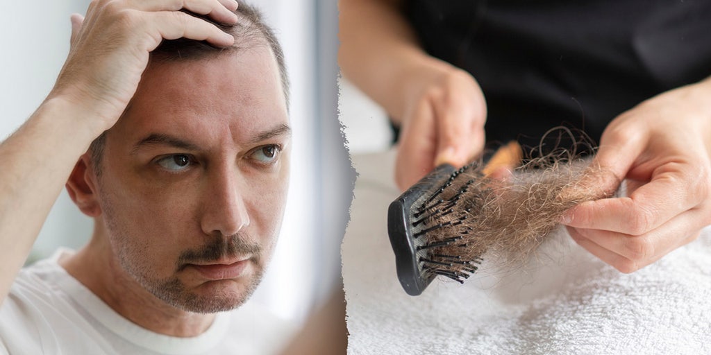 semaglutide hair loss supplements Ozempic, other semaglutides linked to hair loss: Here's what to know