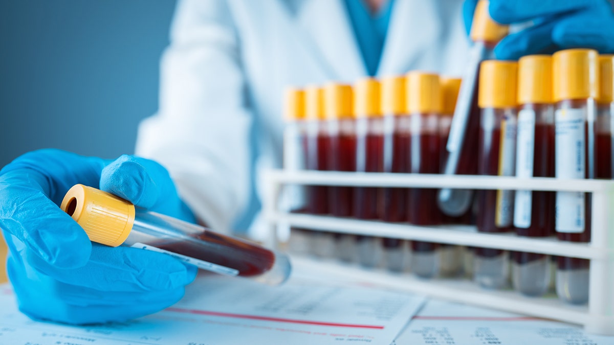 Doctor analyzing blood tests, face obscured, shot focused on gloved hand
