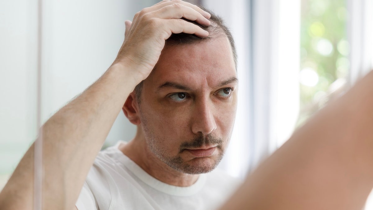 Middle aged man checking his bald spots in the mirror, hair loss concept
