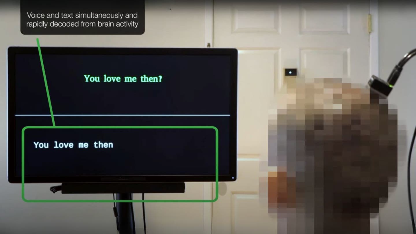 3 ai system restores natural speech for paralyzed patients using their own voices