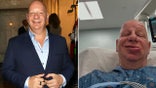 Side by side photos of Jeff Ross at an event and Jeff Ross in a hospital bed with a swollen lip