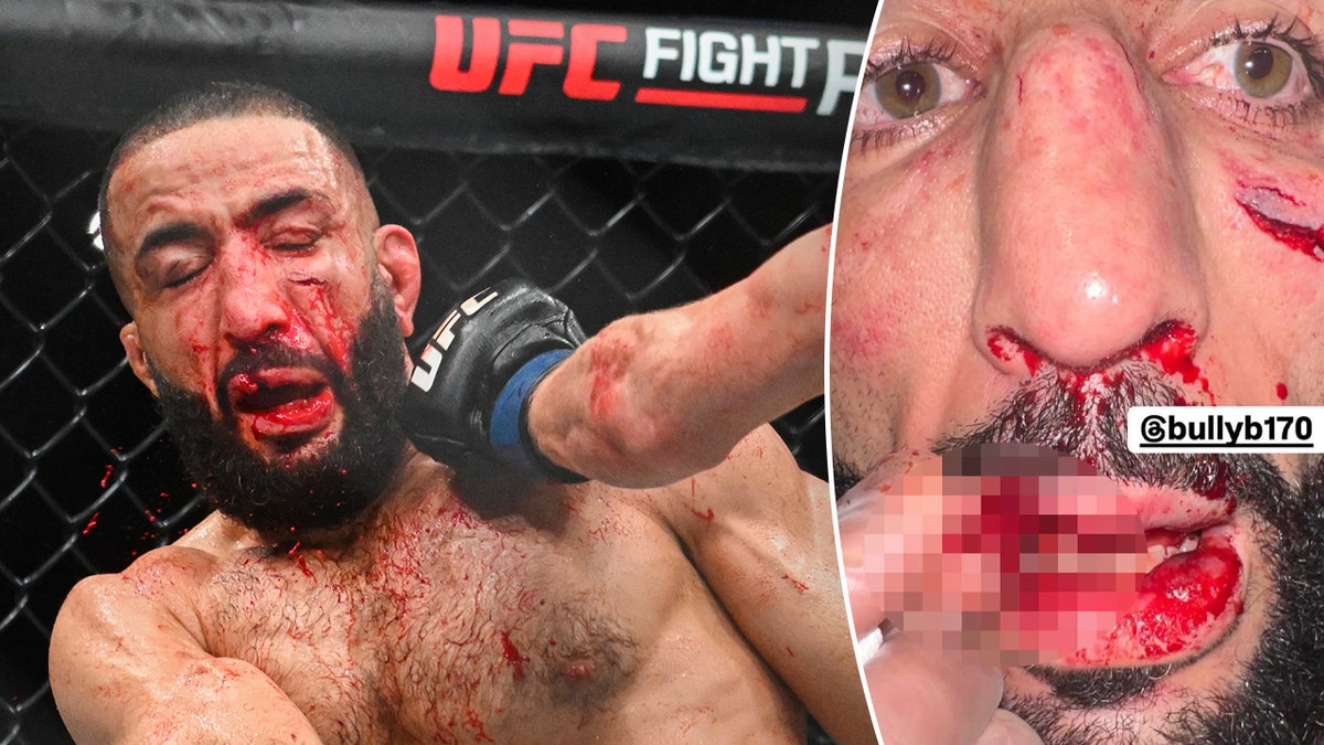 Belal Muhammad wounded bad