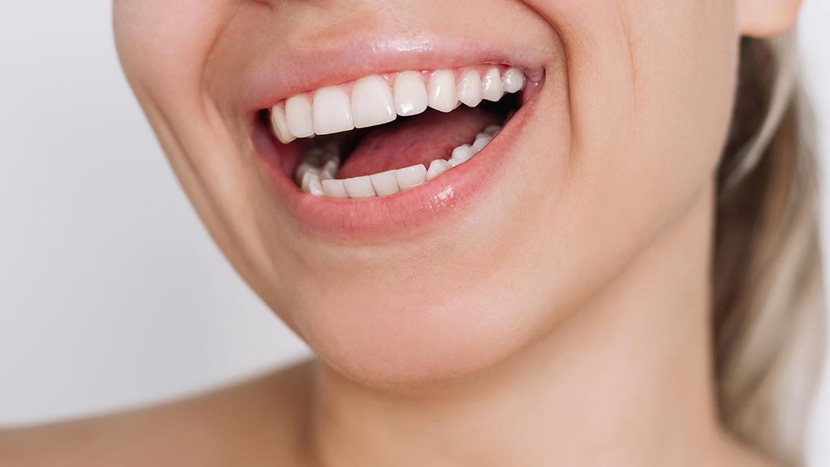 Cropped shot of woman smiling, focus on teeth.