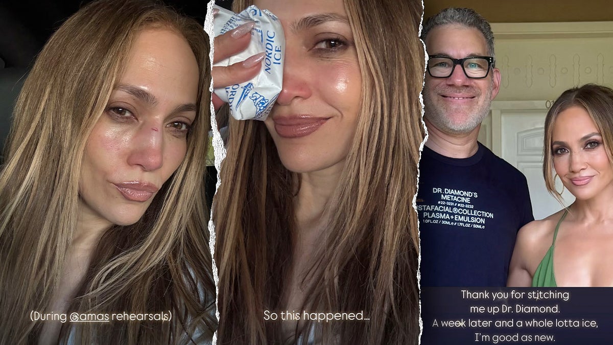 jennifer lopez, injuries