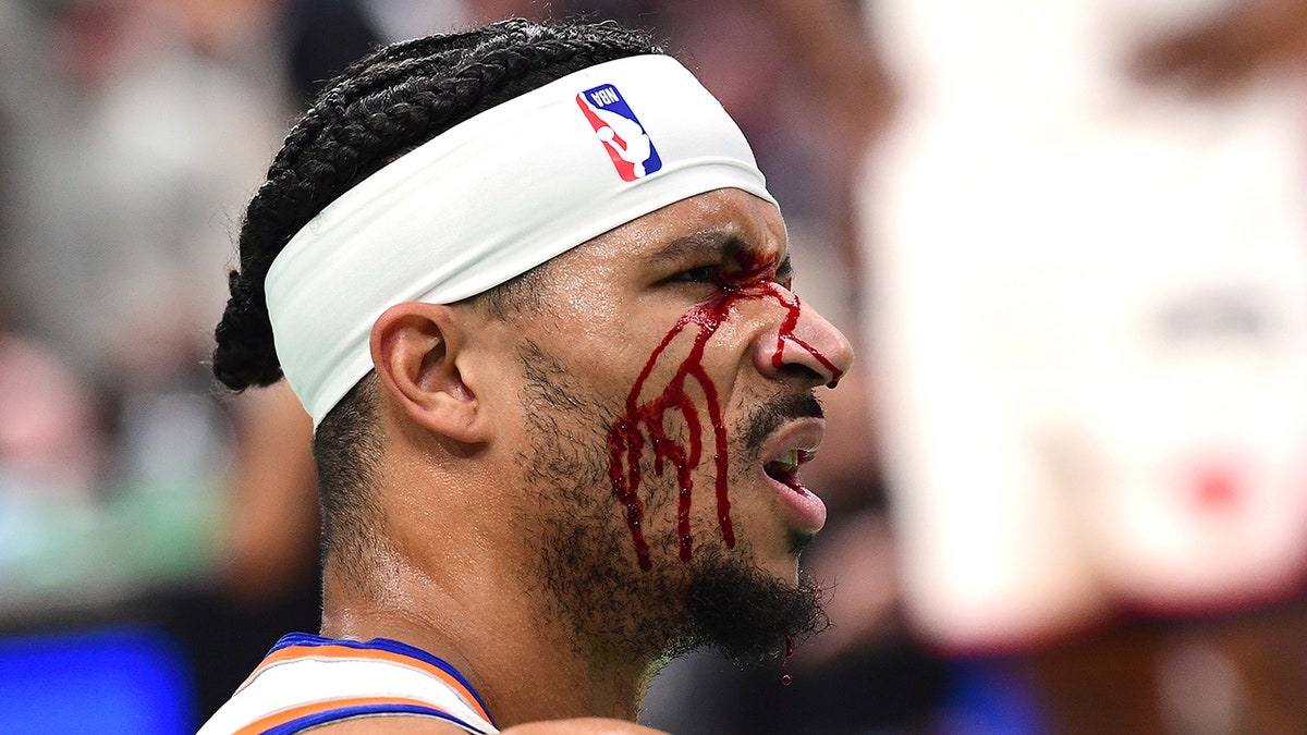 Josh Hart bleeds