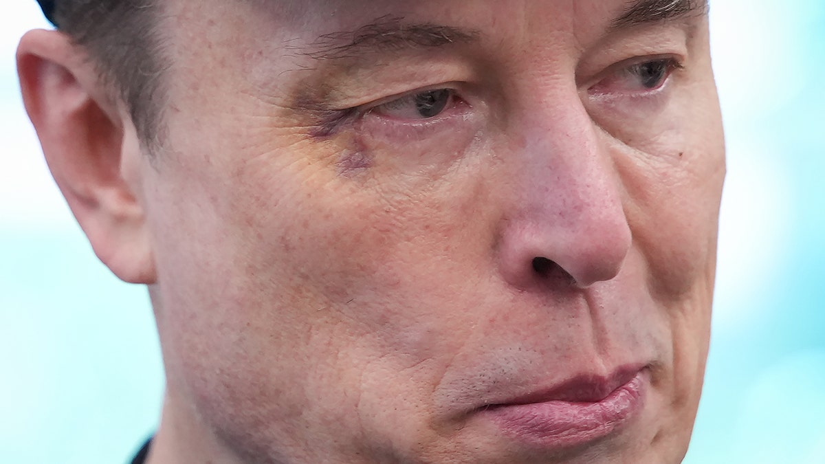 Tesla CEO Elon Musk black eye