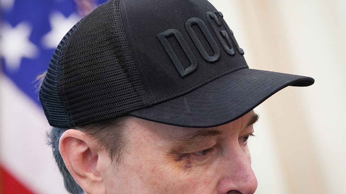 Tesla CEO Elon Musk black eye