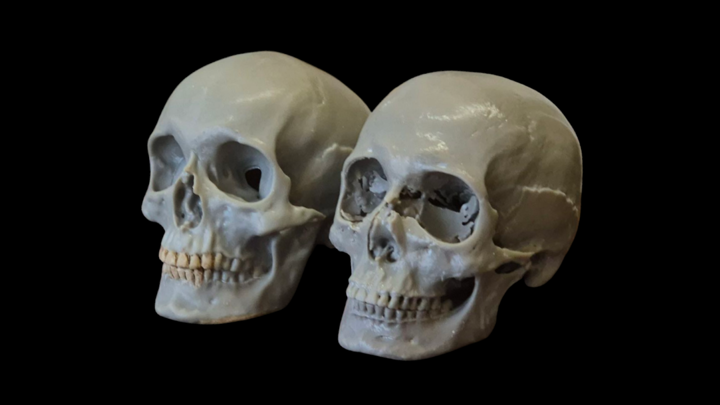 matthias corvinus skull 1