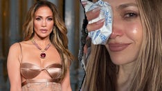 Jennifer Lopez suffers facial injury requiring stitches