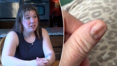 Mom credits TikTok video for cancer diagnosis after spotting strange nail marking