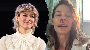 'Lost' star Evangeline Lilly suffers injury from fainting on beach