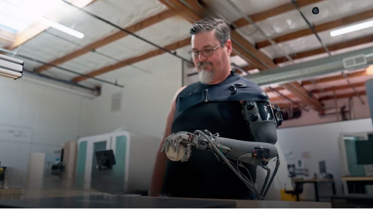 prosthetic arm 4