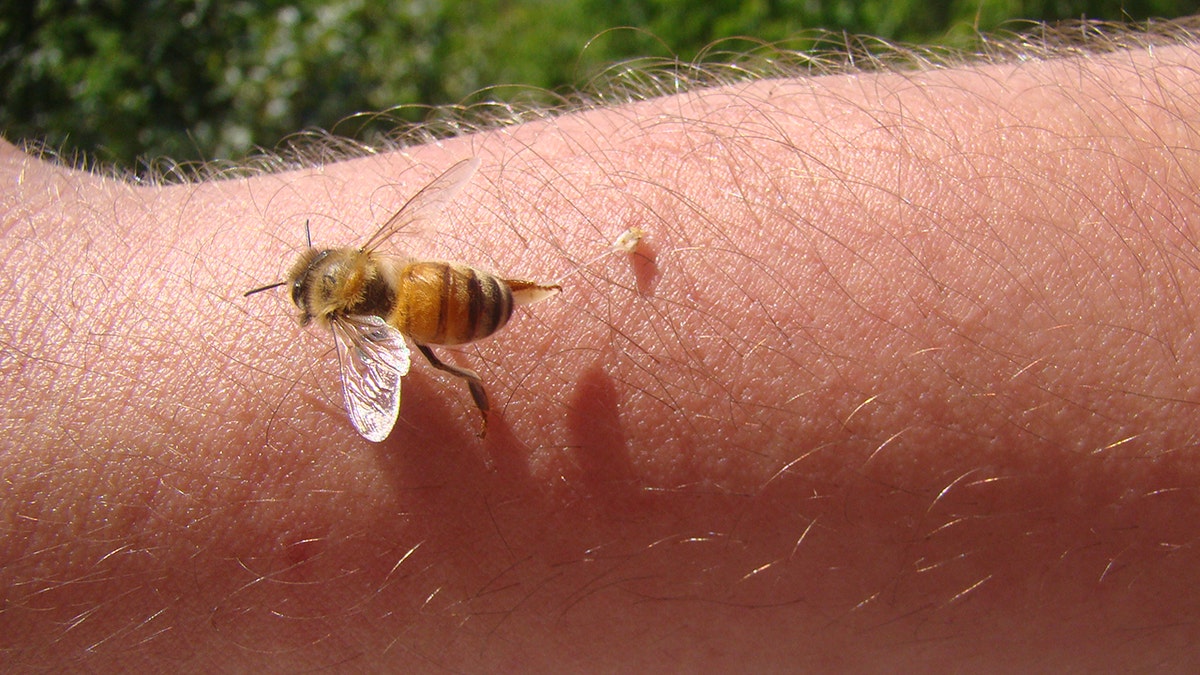 A bee stinging a human arm