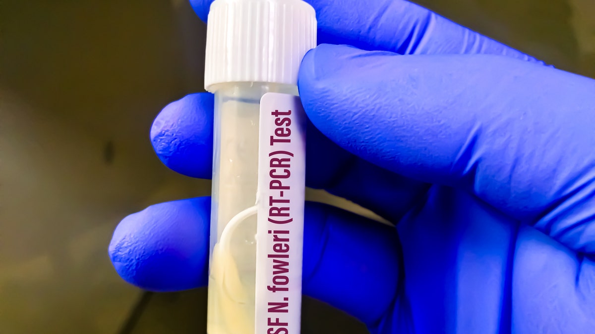 Naegleria fowleri