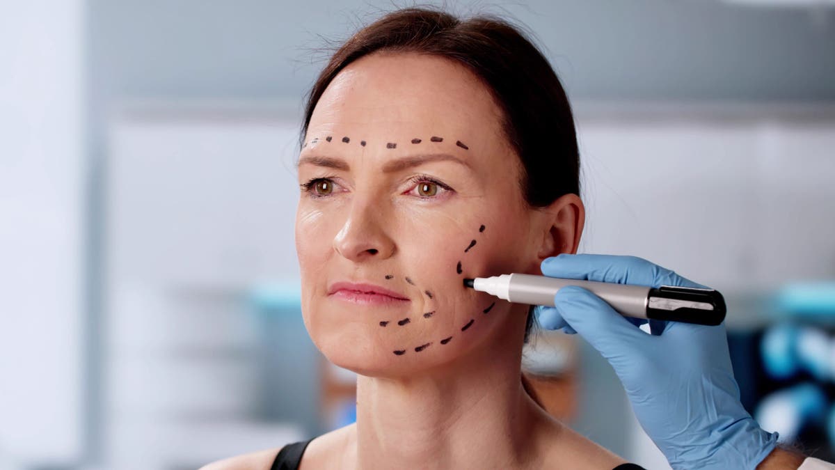 Facelift markings