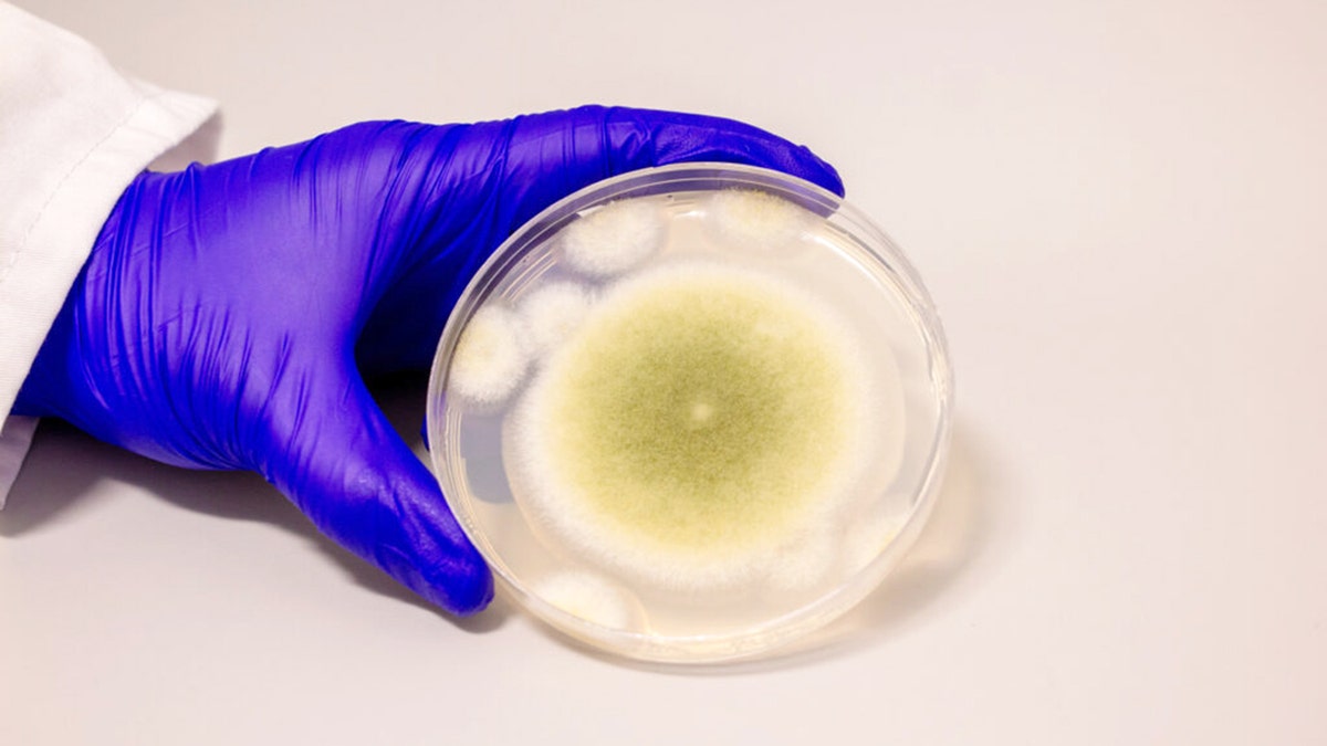 A sample of Aspergillus flavus cultured in the Gao Lab.