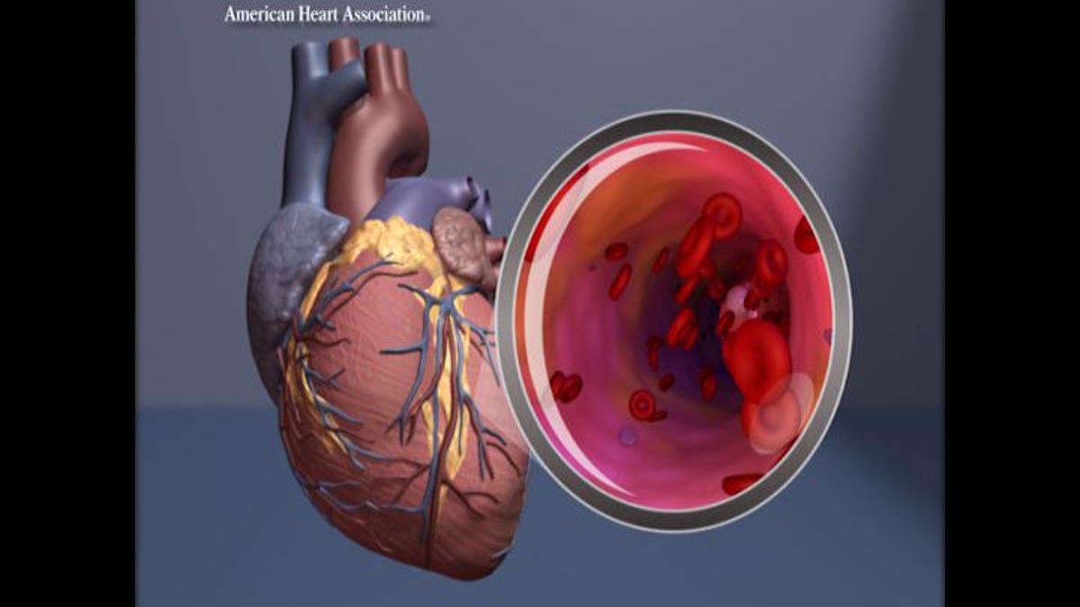 Heart with artery view