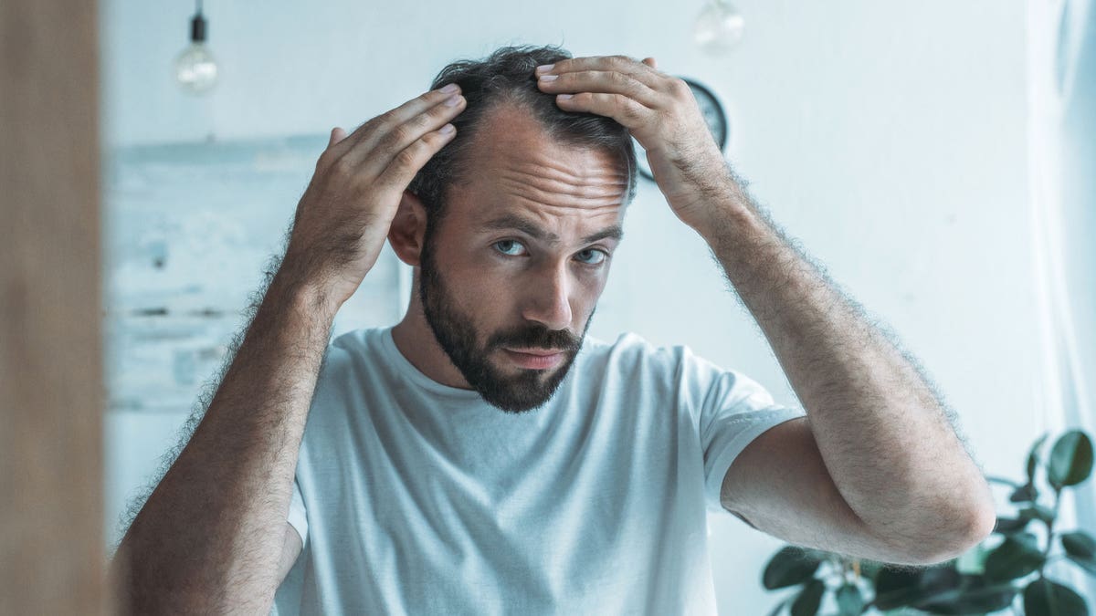 Man hair loss
