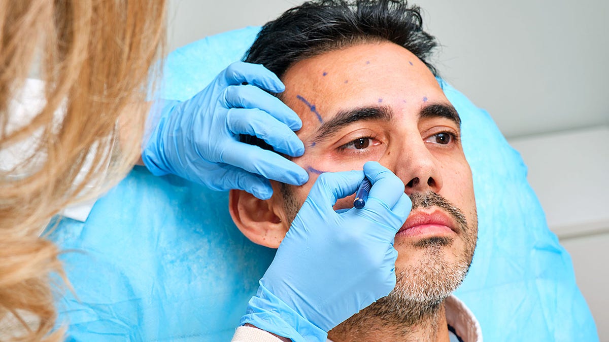 painting nan look of a 45-year-old man for an artistic curen pinch botulinum toxin