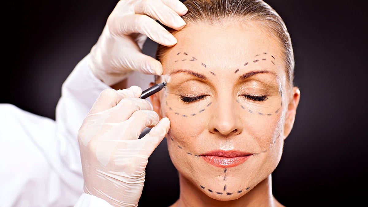 middle aged female pinch correction marks preparing for integrative surgery
