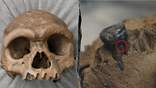 Split of "dragon man" skull and tooth