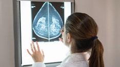 FDA approves first AI tool to predict breast cancer risk
