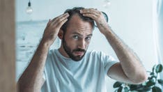 New stem cell therapy shows 'promising' results for treating hair loss in preclinical trials