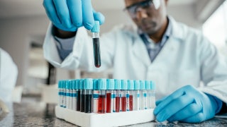 The 'age' of your blood could predict dementia risk, new study suggests