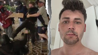 Journalist brutally beaten by Antifa slams media for sweeping violence under rug - Fox News