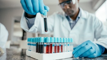 People with 'older' blood faced much higher dementia risk, study finds - Fox News