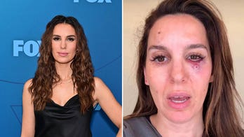 Former Disney star Christy Carlson Romano reveals shocking details about nearly losing her eye