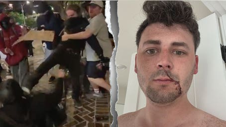 Journalist brutally beaten by Antifa slams media for sweeping violence under rug