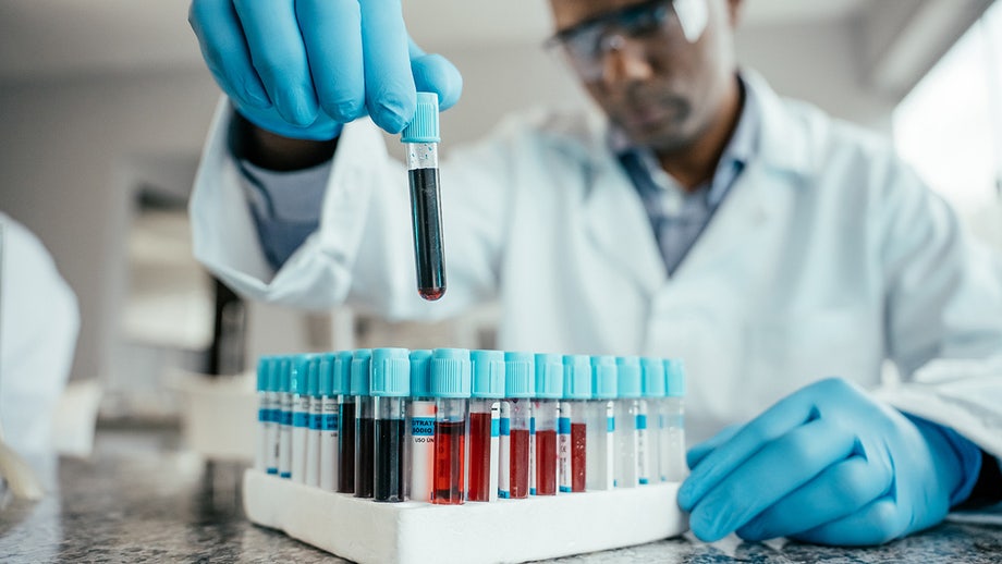 The 'age' of your blood could predict dementia risk, new study suggests