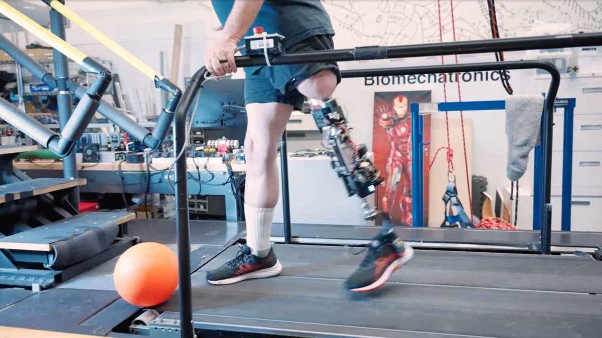 A man kicking a ball while wearing the e-OPRA bionic knee prosthesis.